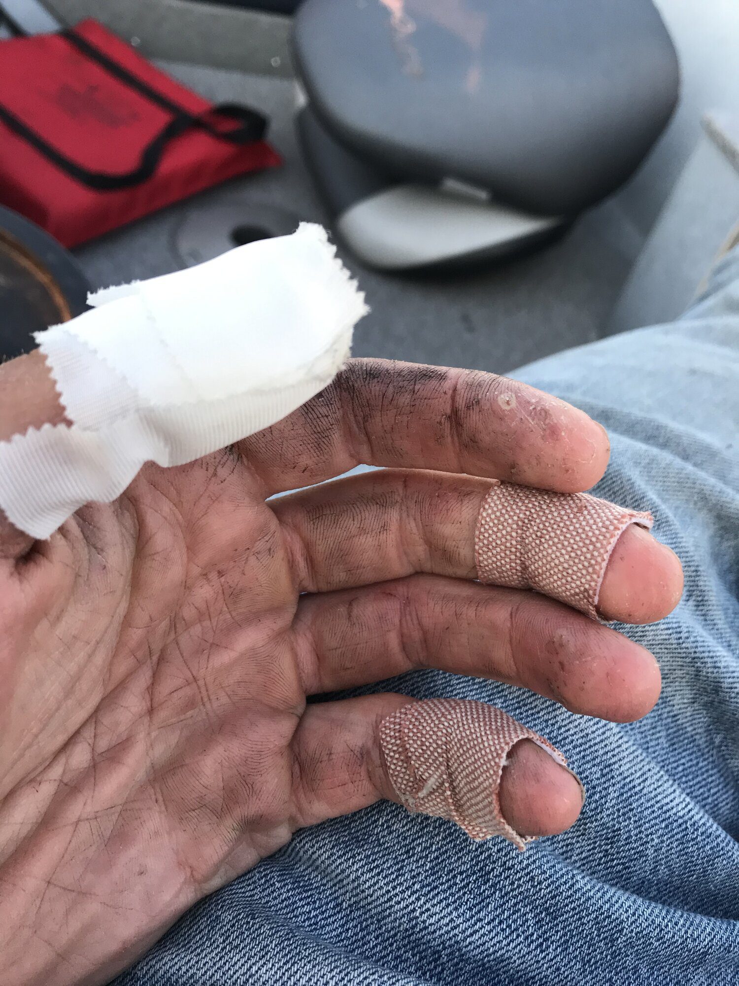 Pike bite on hand